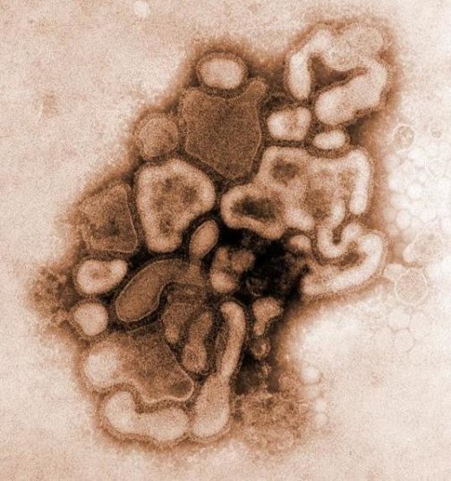 swineflu.jpg, 68 KB